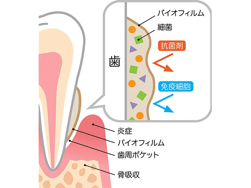 向ヶ丘遊園、登戸の歯医者、近藤歯科で予防歯科