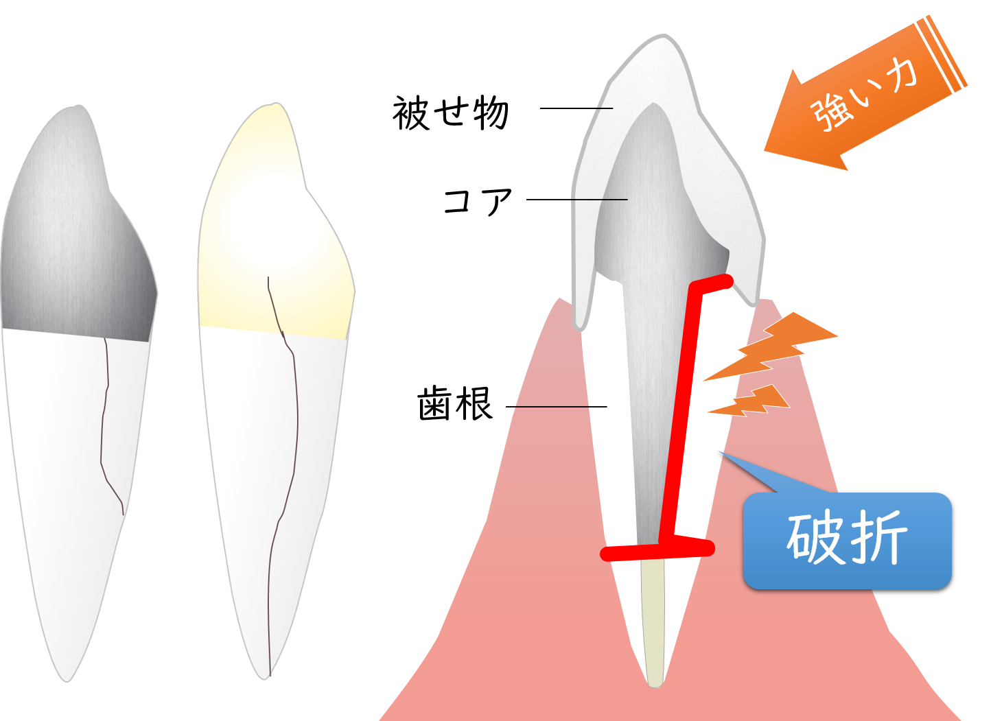 向ヶ丘遊園、登戸の歯医者、近藤歯科で歯科用CT