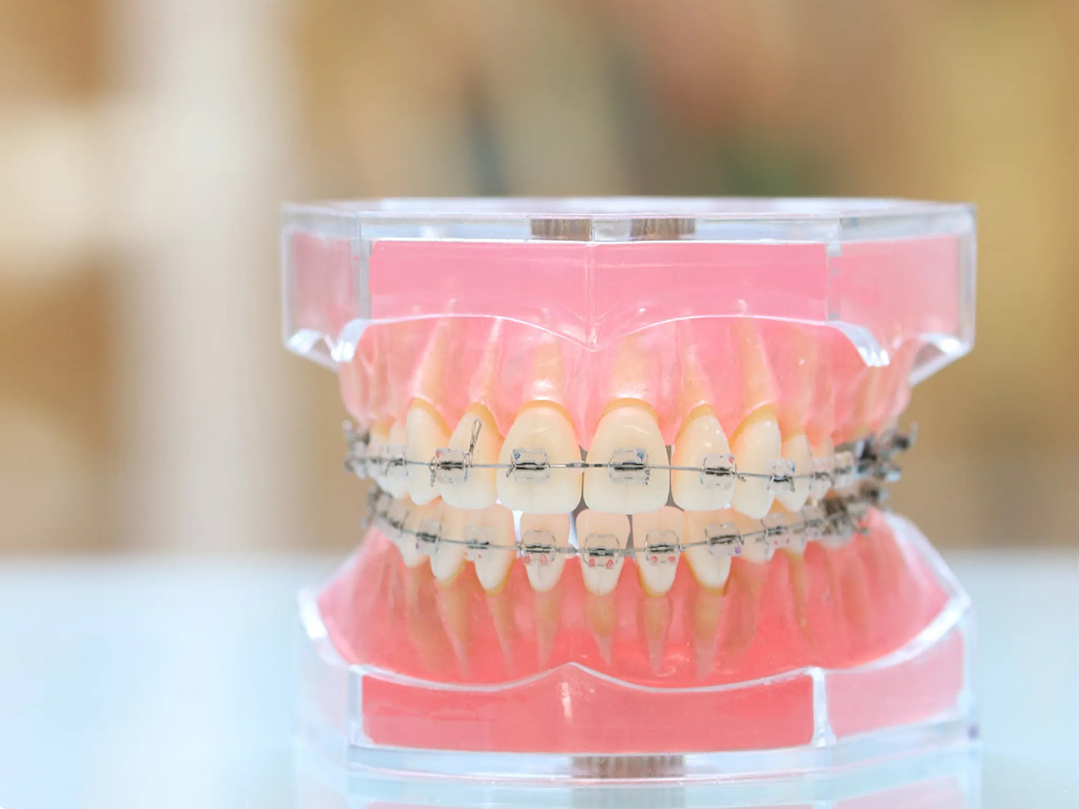 矯正歯科 - 近藤歯科｜向ヶ丘遊園駅徒歩0分、登戸駅からも近い