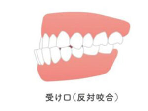 向ヶ丘遊園駅徒歩0分、登戸駅からも近い歯医者、近藤歯科で、「口角」が上がりにくいのは歯並びのせい？口元の筋肉と噛み合わせの関係を解説