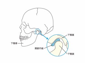 向ヶ丘遊園駅徒歩0分、登戸駅からも近い歯医者、近藤歯科で、顎関節の音が「ミシミシ」に変わったら要注意？顎関節症の進行度と受診したほうがいい症状を解説